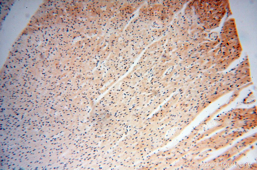 Immunohistochemistry (IHC) staining of human heart tissue using CNBP Polyclonal antibody (14717-1-AP)