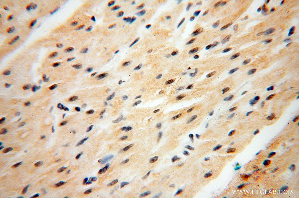 Immunohistochemistry (IHC) staining of human heart tissue using CNBP Polyclonal antibody (14717-1-AP)