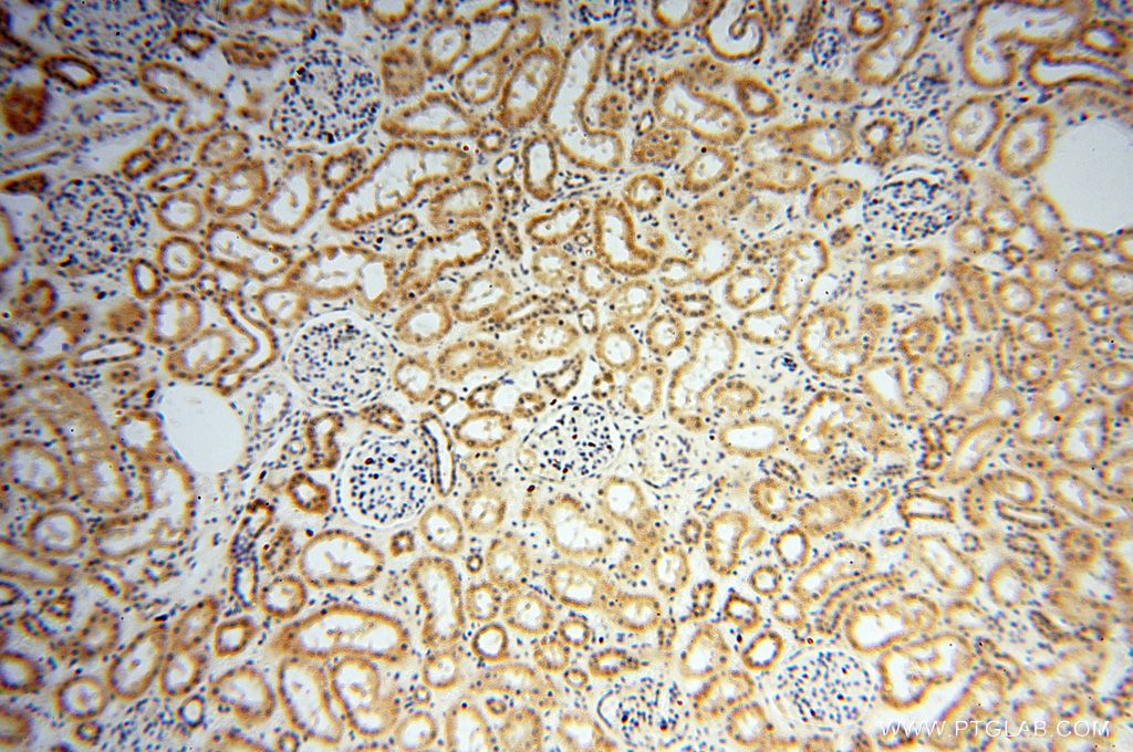 Immunohistochemistry (IHC) staining of human kidney tissue using CNBP Polyclonal antibody (14717-1-AP)