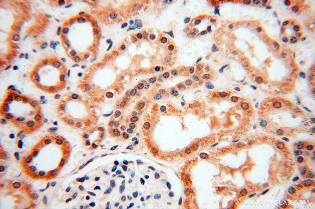 Immunohistochemistry (IHC) staining of human kidney tissue using CNBP Polyclonal antibody (14717-1-AP)