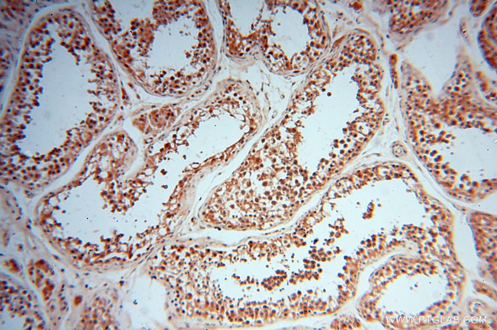 Immunohistochemistry (IHC) staining of human testis tissue using CNBP Polyclonal antibody (14717-1-AP)