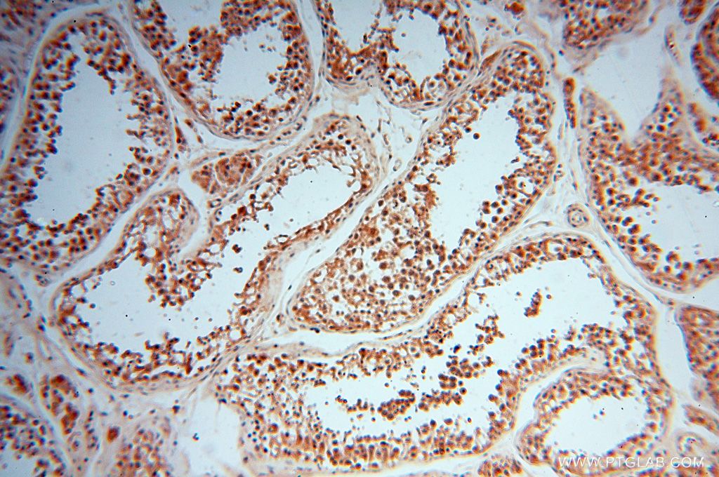 IHC staining of human testis using 14717-1-AP