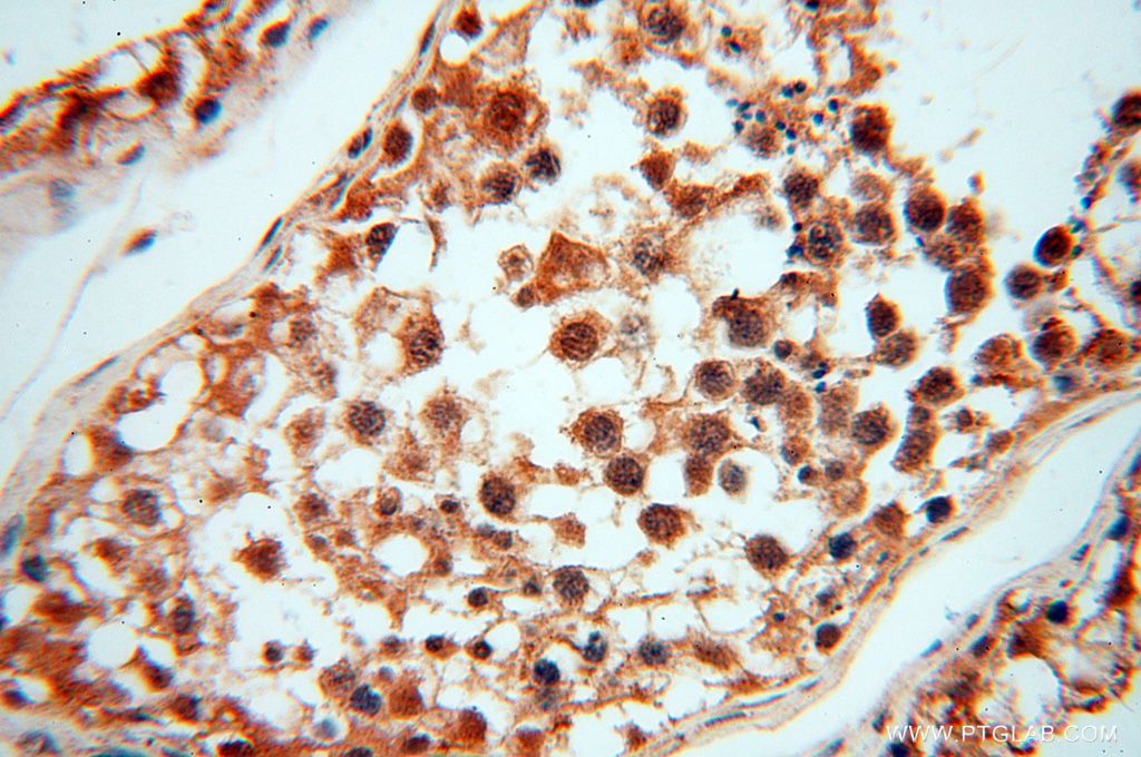 Immunohistochemistry (IHC) staining of human testis tissue using CNBP Polyclonal antibody (14717-1-AP)