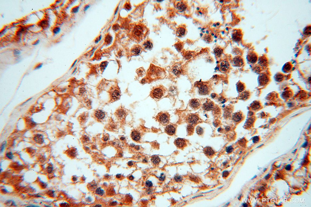 IHC staining of human testis using 14717-1-AP