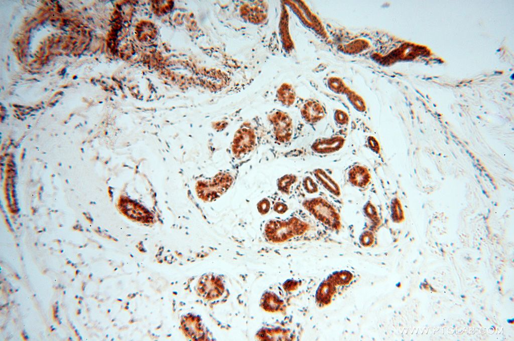 Immunohistochemistry (IHC) staining of human skin tissue using CNBP Polyclonal antibody (14717-1-AP)
