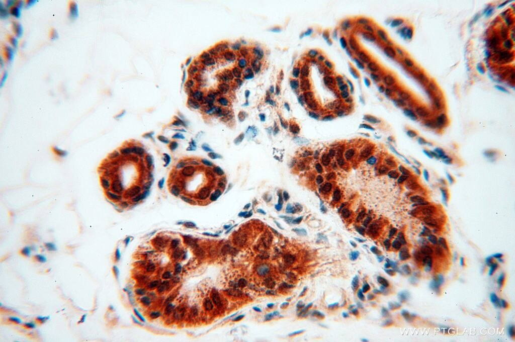 Immunohistochemistry (IHC) staining of human skin tissue using CNBP Polyclonal antibody (14717-1-AP)