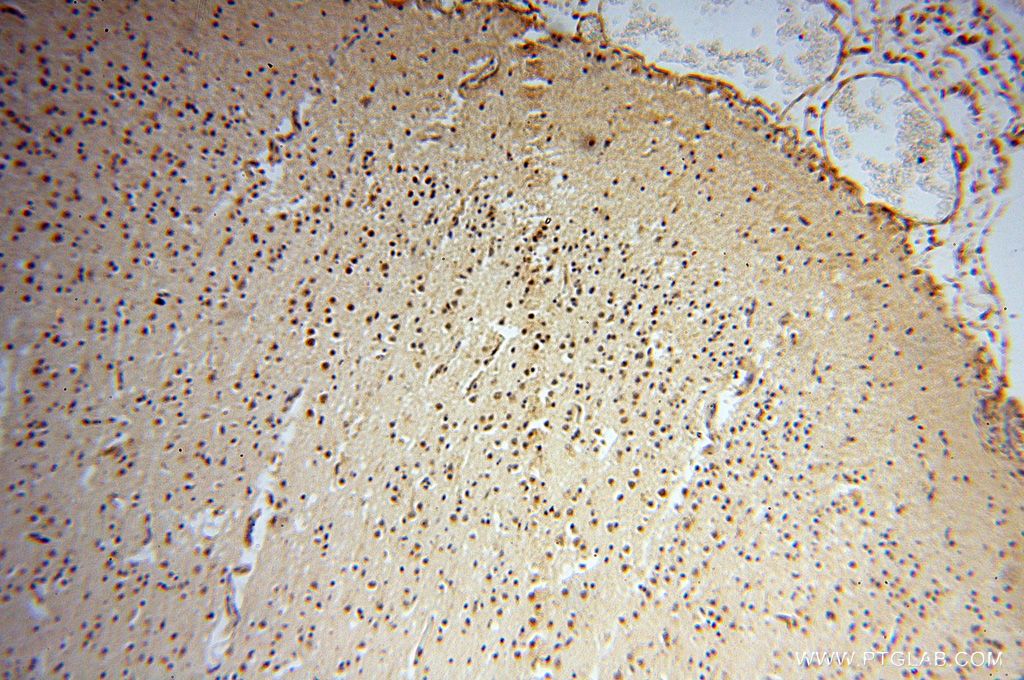 Immunohistochemistry (IHC) staining of human brain tissue using CNBP Polyclonal antibody (14717-1-AP)