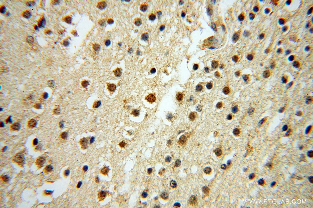 Immunohistochemistry (IHC) staining of human brain tissue using CNBP Polyclonal antibody (14717-1-AP)