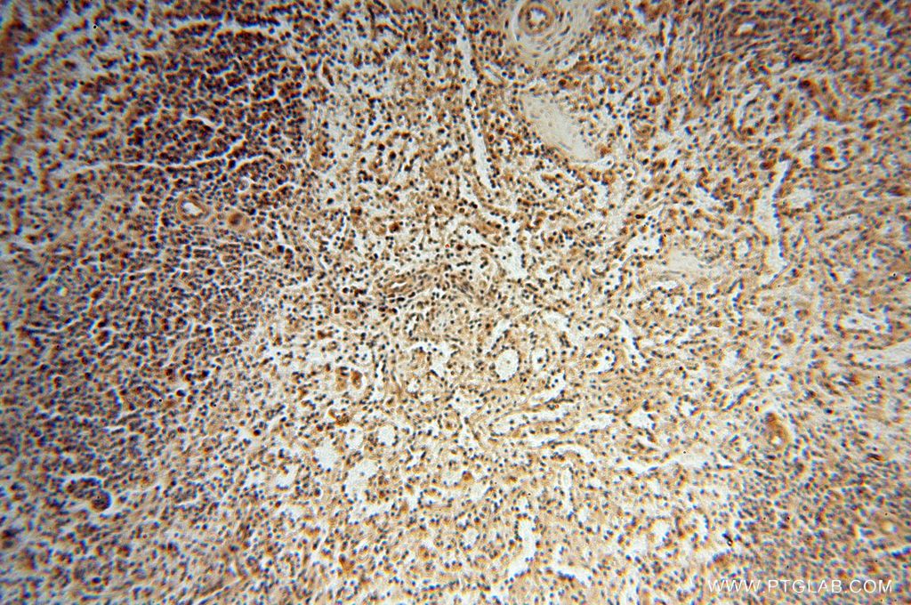 Immunohistochemistry (IHC) staining of human spleen tissue using CNBP Polyclonal antibody (14717-1-AP)