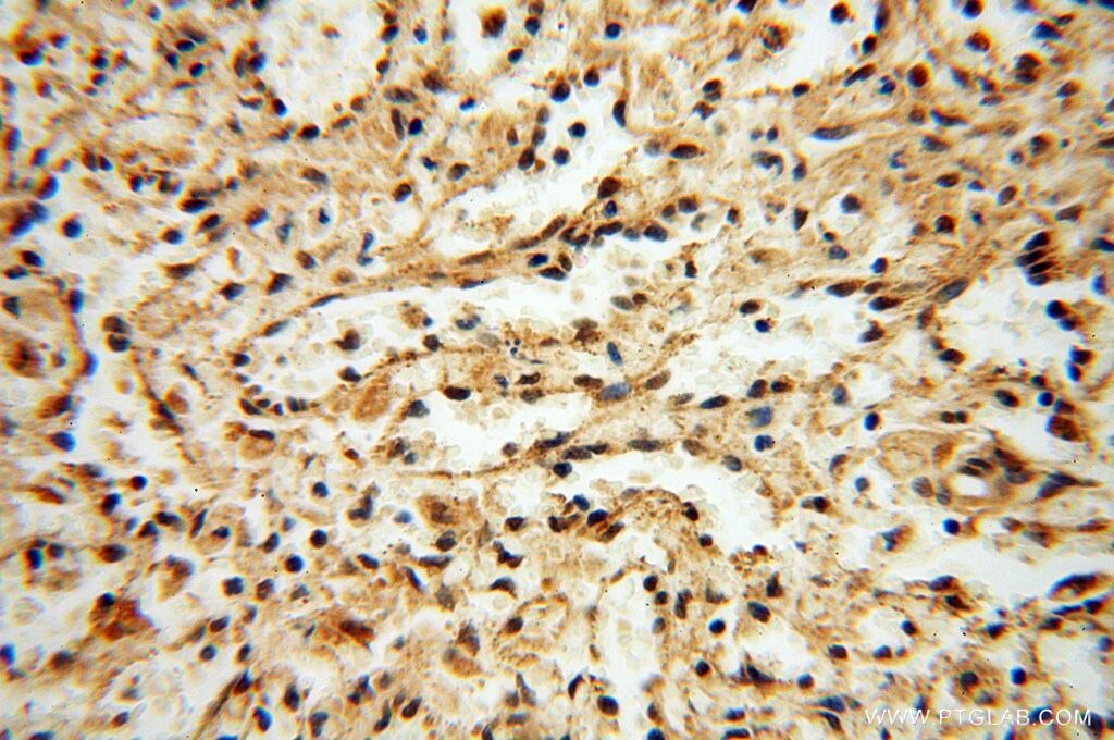 Immunohistochemistry (IHC) staining of human spleen tissue using CNBP Polyclonal antibody (14717-1-AP)