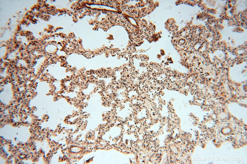 Immunohistochemistry (IHC) staining of human lung tissue using CNBP Polyclonal antibody (14717-1-AP)