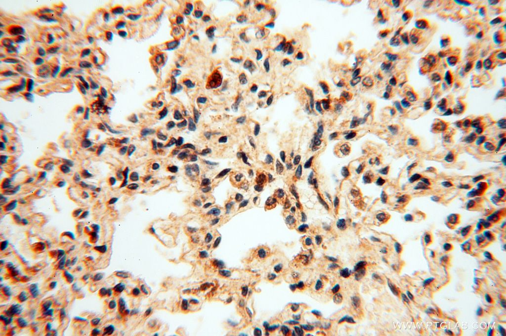 Immunohistochemistry (IHC) staining of human lung tissue using CNBP Polyclonal antibody (14717-1-AP)