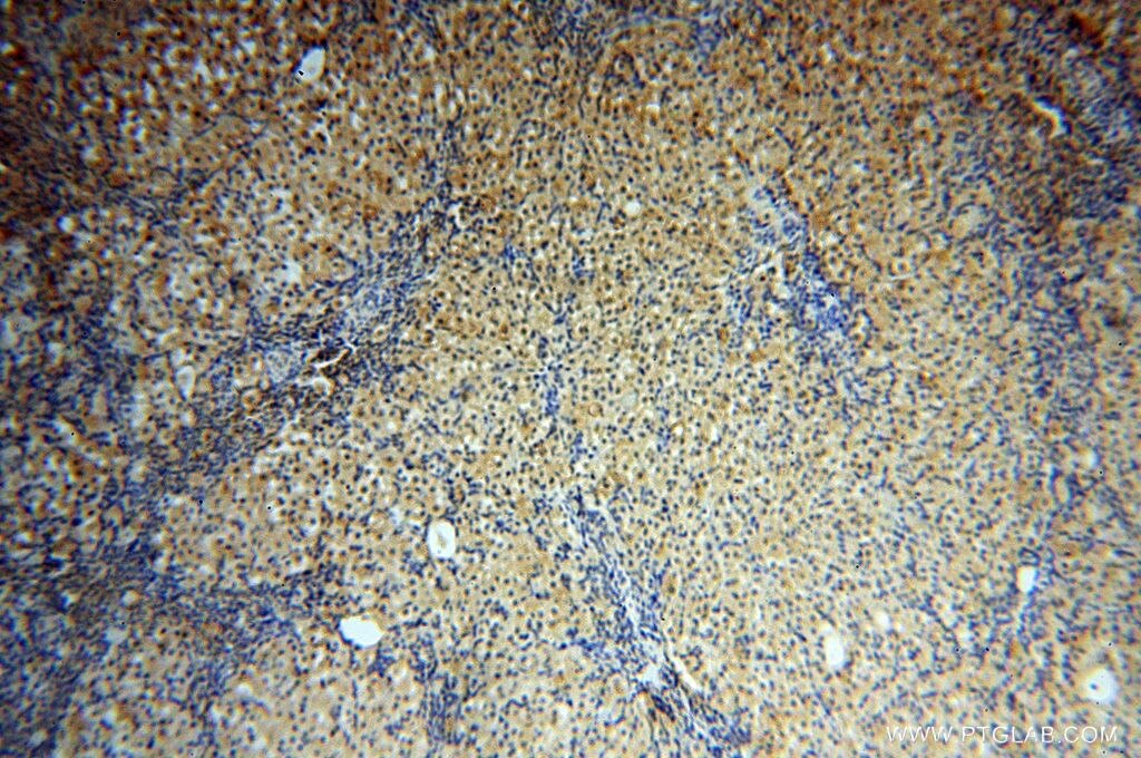 Immunohistochemistry (IHC) staining of human ovary tissue using CNBP Polyclonal antibody (14717-1-AP)