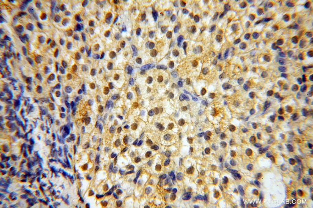 Immunohistochemistry (IHC) staining of human ovary tissue using CNBP Polyclonal antibody (14717-1-AP)