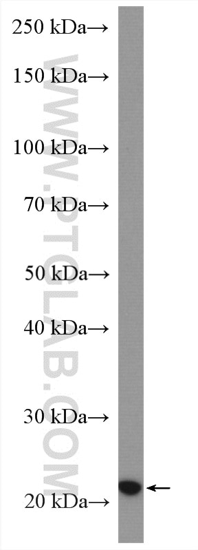 Western Blot (WB) analysis of Caco-2 cells using CNBP Polyclonal antibody (14717-1-AP)