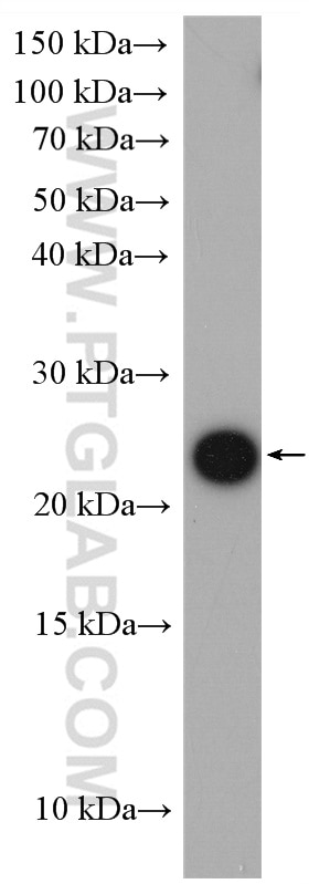Western Blot (WB) analysis of HeLa cells using CNBP Polyclonal antibody (14717-1-AP)