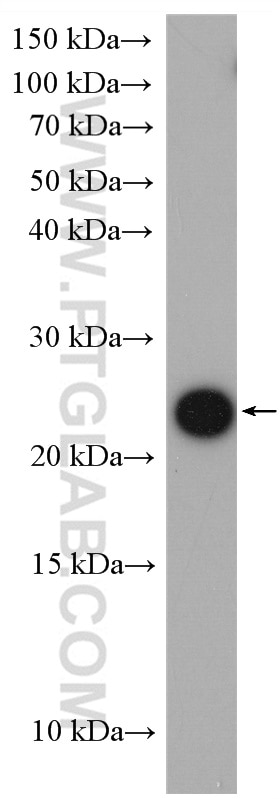 WB analysis of HeLa using 14717-1-AP