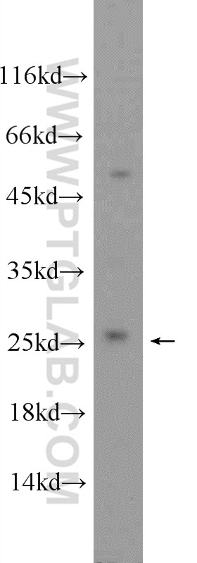 Western Blot (WB) analysis of mouse heart tissue using CNBP Polyclonal antibody (14717-1-AP)