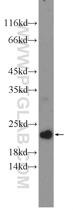 Western Blot (WB) analysis of mouse testis tissue using CNBP Polyclonal antibody (14717-1-AP)