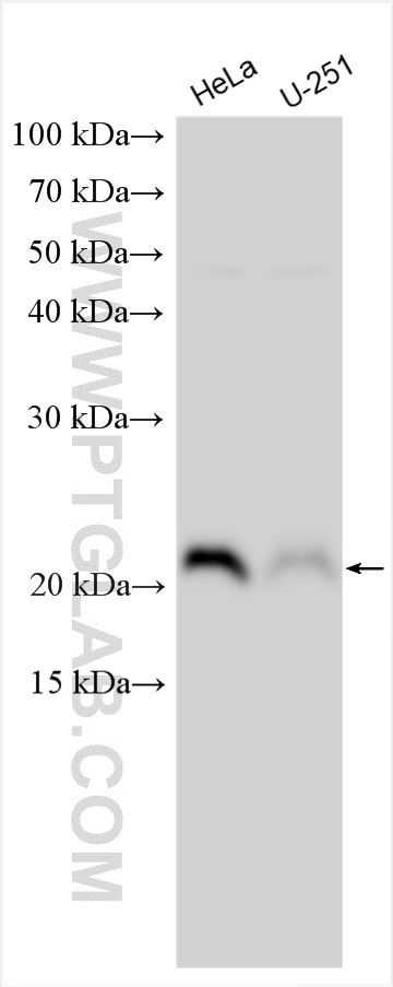 Western Blot (WB) analysis of various lysates using CNBP Polyclonal antibody (14717-1-AP)
