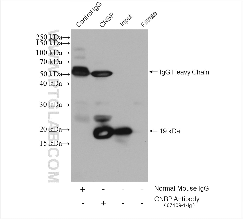 Immunoprecipitation (IP) experiment of HeLa cells using CNBP Monoclonal antibody (67109-1-Ig)