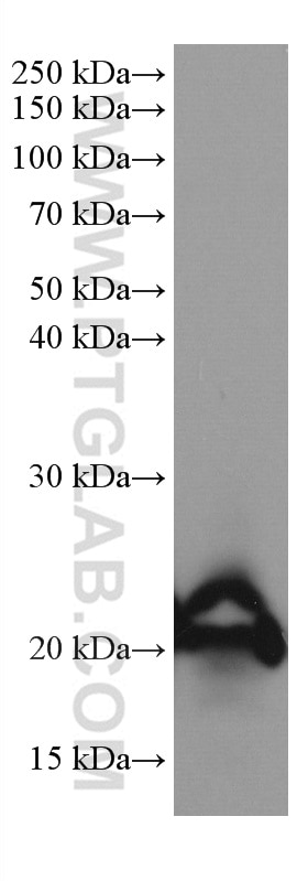 Western Blot (WB) analysis of Jurkat cells using CNBP Monoclonal antibody (67109-1-Ig)