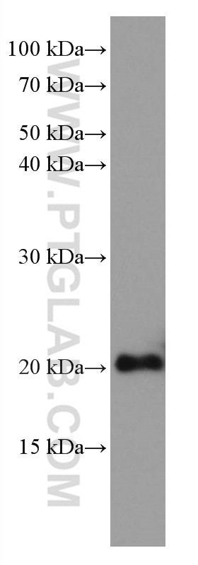 Western Blot (WB) analysis of HeLa cells using CNBP Monoclonal antibody (67109-1-Ig)