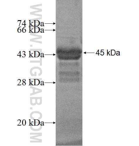 CNBP fusion protein Ag2747 SDS-PAGE