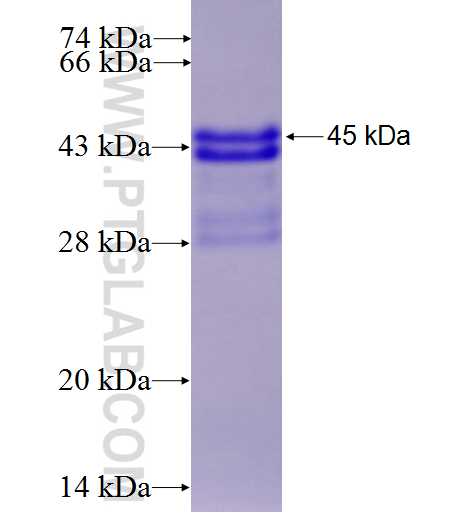 CNBP fusion protein Ag6441 SDS-PAGE