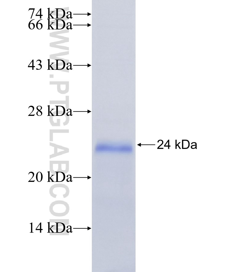 CNBP fusion protein Ag7114 SDS-PAGE