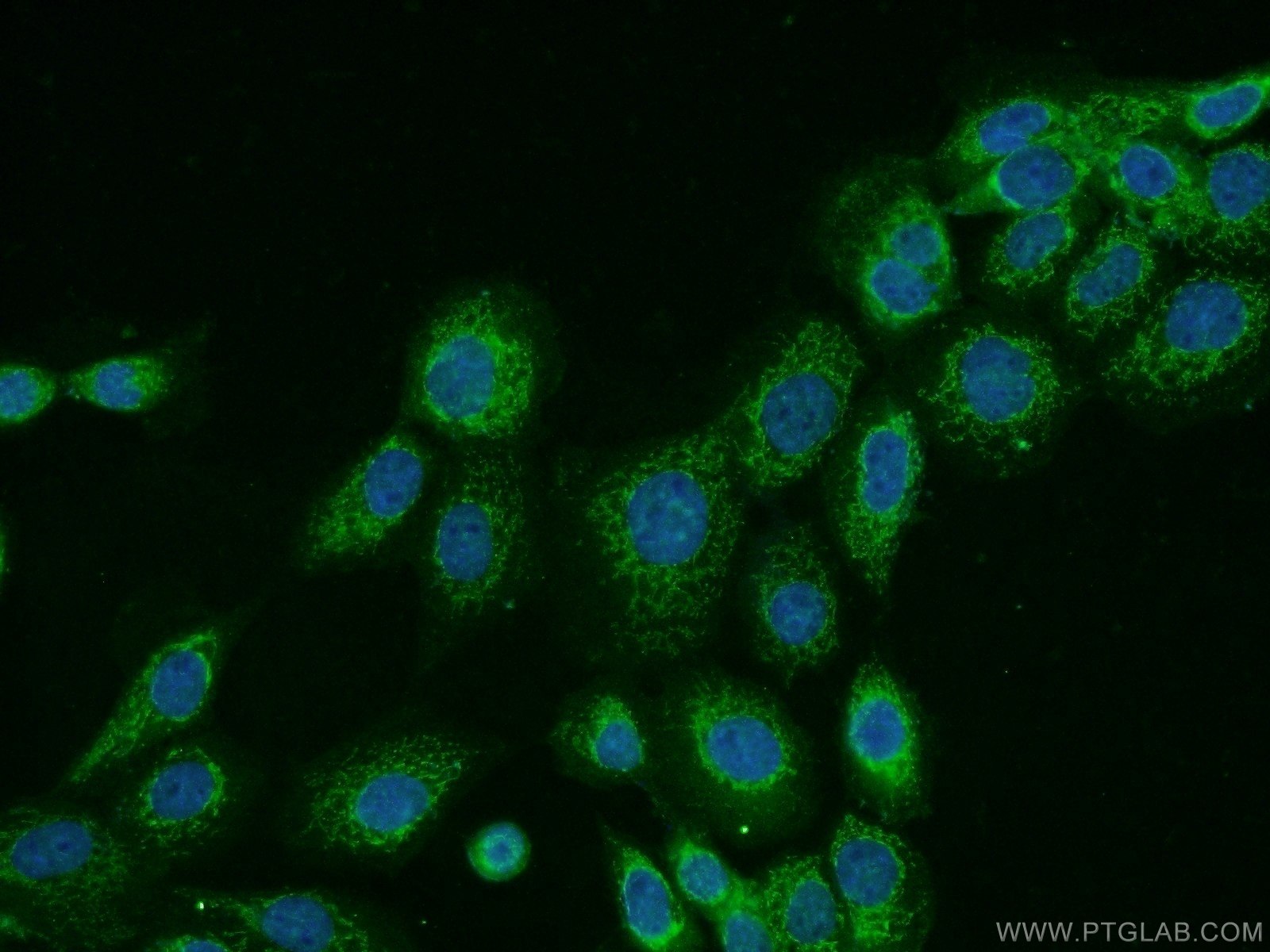 Immunofluorescence (IF) / fluorescent staining of A431 cells using CNDP1 Polyclonal antibody (17759-1-AP)
