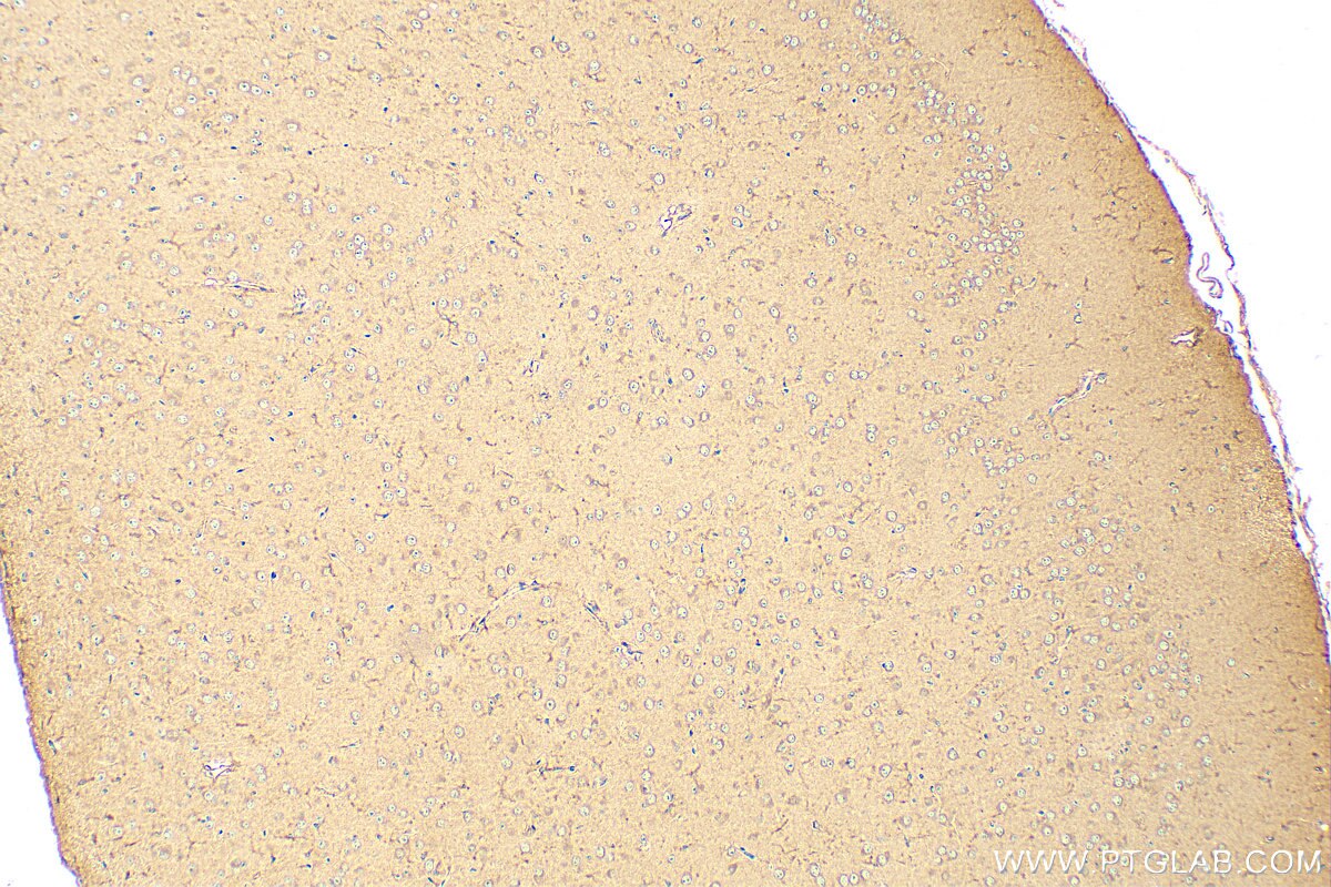 Immunohistochemistry (IHC) staining of mouse brain tissue using CNDP1 Polyclonal antibody (17759-1-AP)