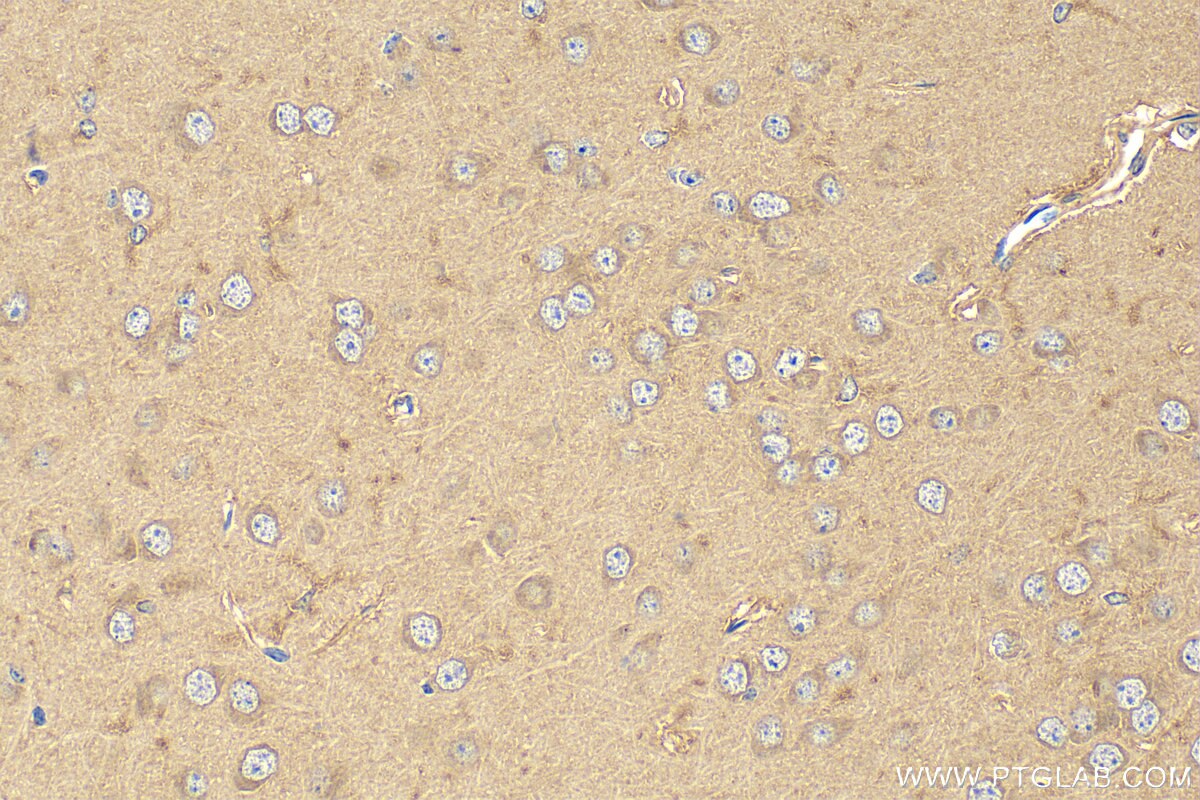 IHC staining of mouse brain using 17759-1-AP