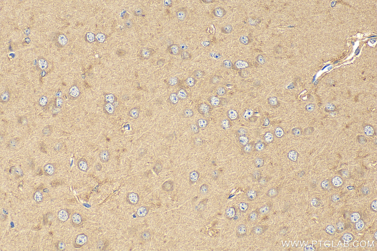 Immunohistochemistry (IHC) staining of mouse brain tissue using CNDP1 Polyclonal antibody (17759-1-AP)