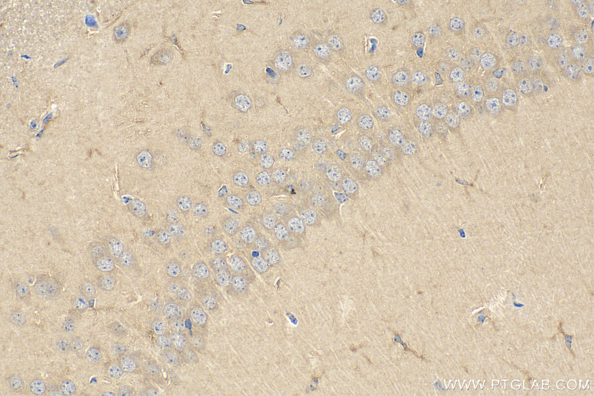 Immunohistochemistry (IHC) staining of mouse brain tissue using CNDP1 Polyclonal antibody (17759-1-AP)