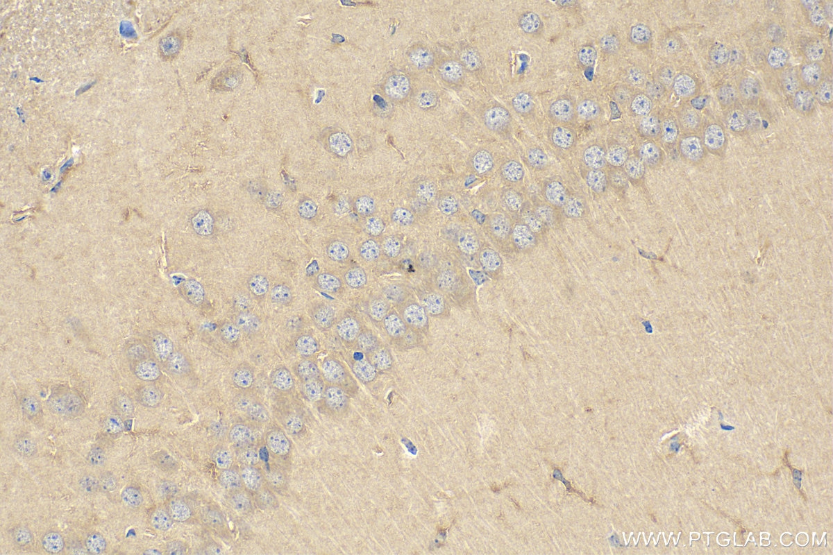 Immunohistochemistry (IHC) staining of mouse brain tissue using CNDP1 Polyclonal antibody (17759-1-AP)