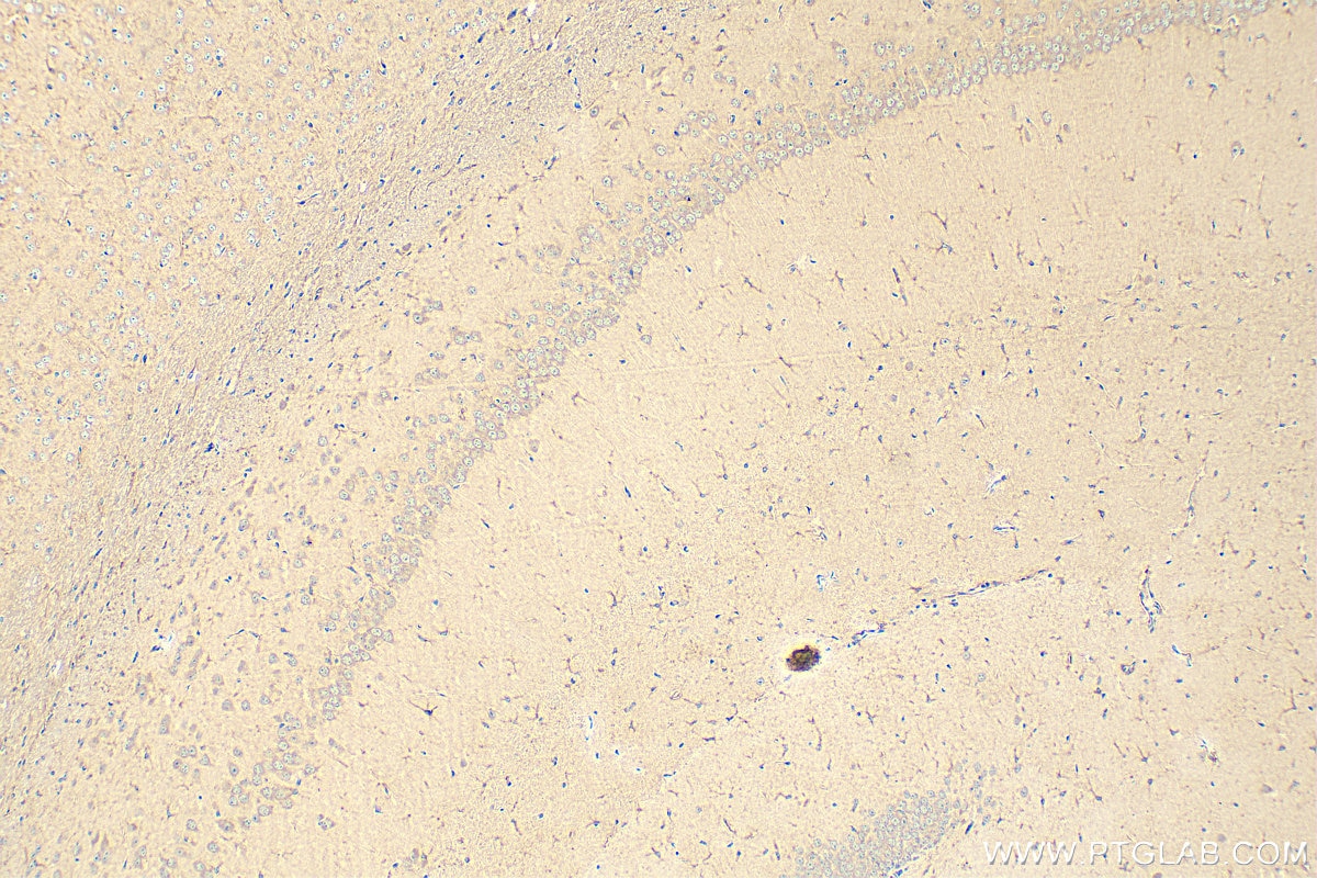 Immunohistochemistry (IHC) staining of mouse brain tissue using CNDP1 Polyclonal antibody (17759-1-AP)