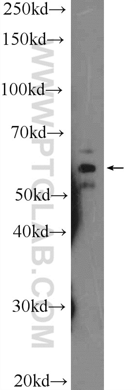 Western Blot (WB) analysis of A431 cells using CNDP1 Polyclonal antibody (17759-1-AP)