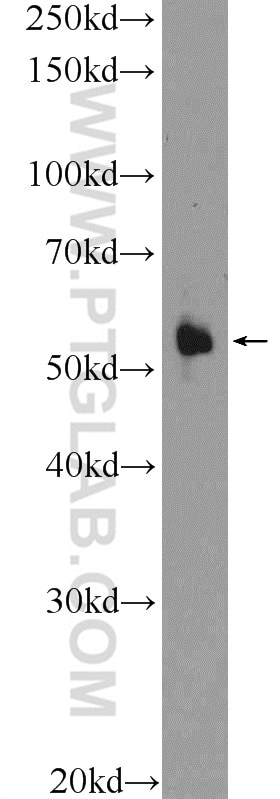 Western Blot (WB) analysis of HEK-293 cells using CNDP1 Polyclonal antibody (17759-1-AP)