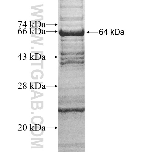 CNDP1 fusion protein Ag12127 SDS-PAGE