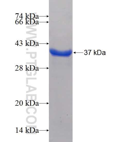 CNDP1 fusion protein Ag12251 SDS-PAGE