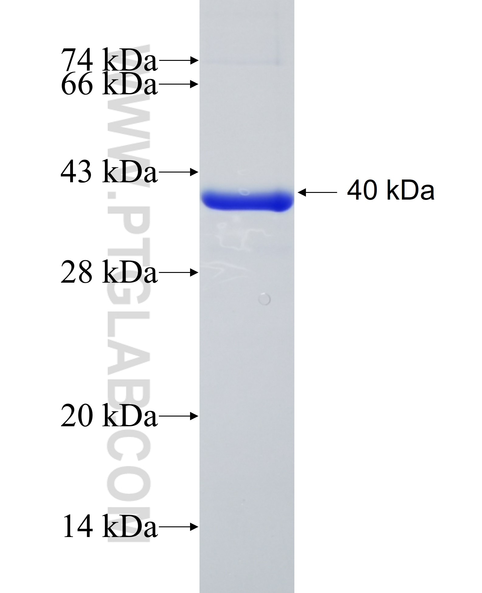 CNDP1 fusion protein Ag12251 SDS-PAGE