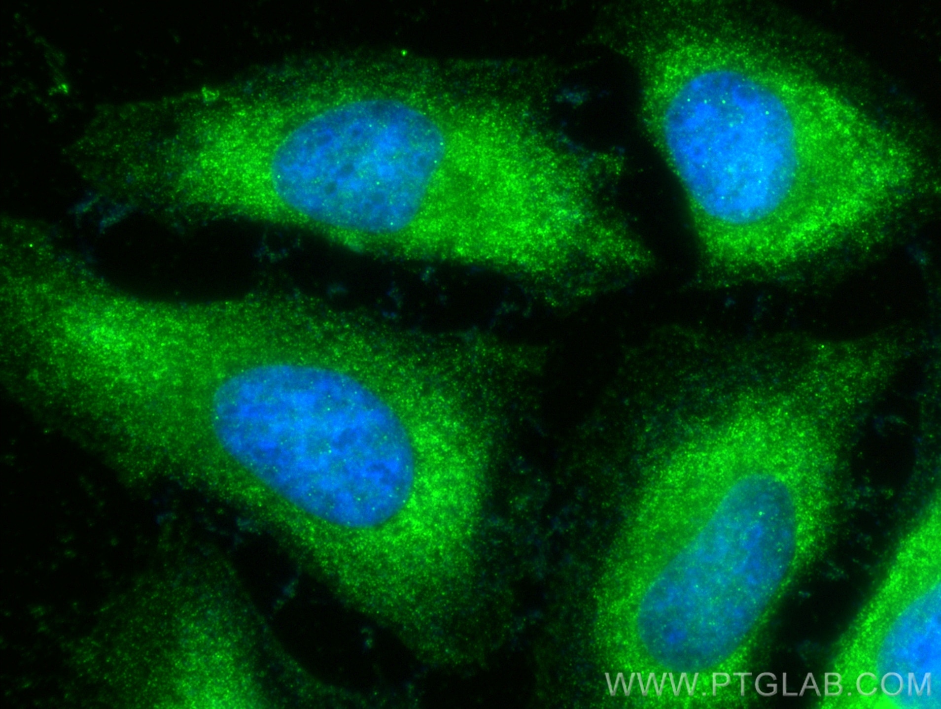 Immunofluorescence (IF) / fluorescent staining of HeLa cells using CNDP2 Polyclonal antibody (14925-1-AP)