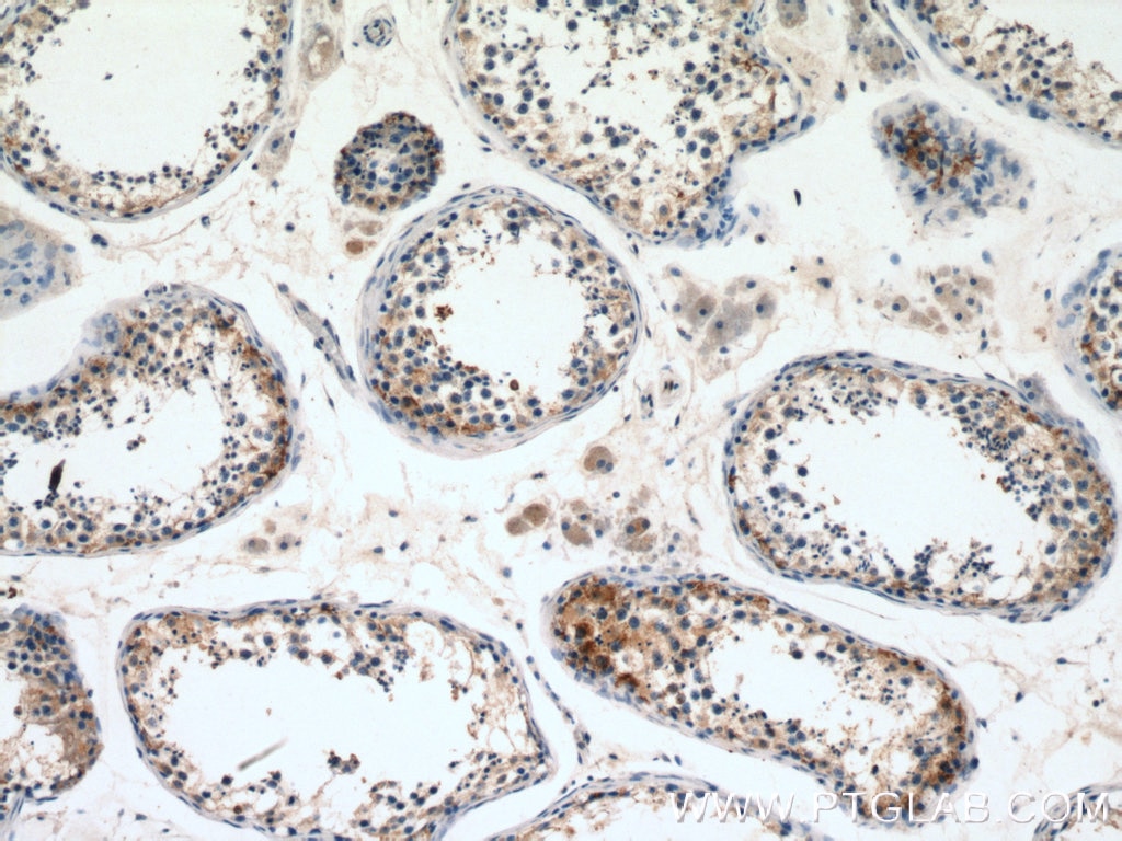 Immunohistochemistry (IHC) staining of human testis tissue using CNDP2 Polyclonal antibody (14925-1-AP)