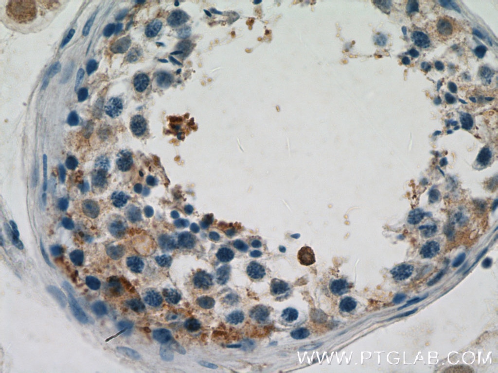 Immunohistochemistry (IHC) staining of human testis tissue using CNDP2 Polyclonal antibody (14925-1-AP)