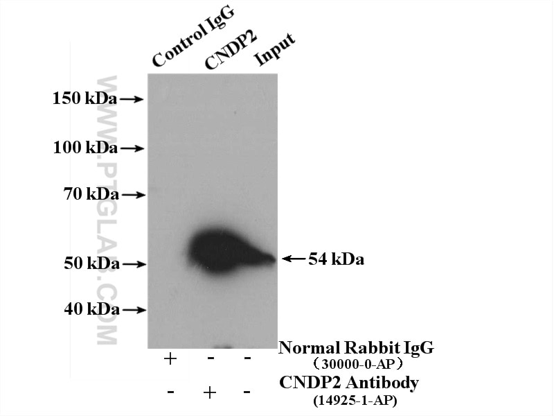 Immunoprecipitation (IP) experiment of mouse testis tissue using CNDP2 Polyclonal antibody (14925-1-AP)