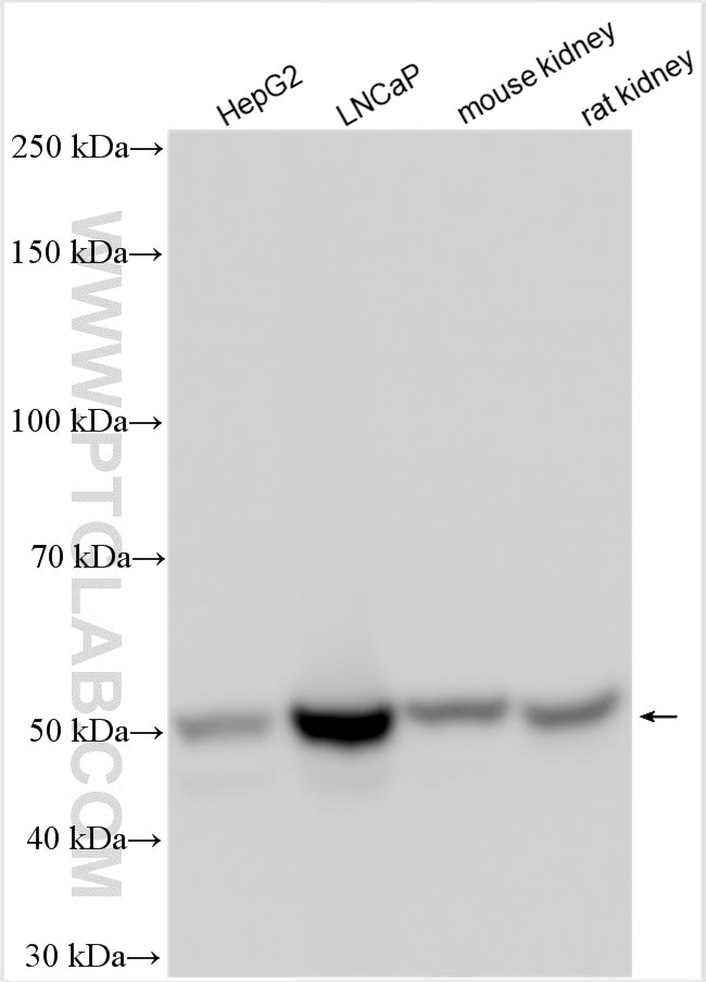 Western Blot (WB) analysis of various lysates using CNDP2 Polyclonal antibody (14925-1-AP)