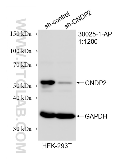 Western Blot (WB) analysis of HEK-293T cells using CNDP2 Polyclonal antibody (30025-1-AP)