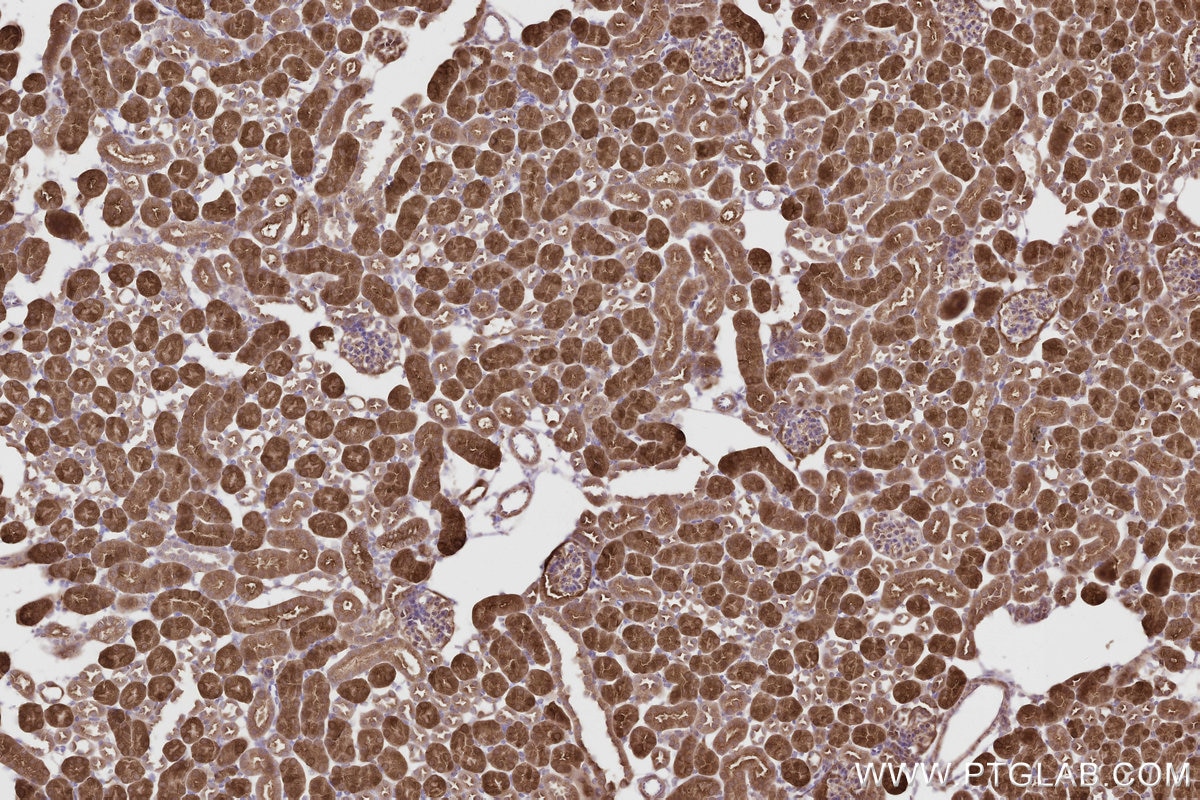 IHC staining of mouse kidney using 84924-7-RR Immunohistochemistry (IHC) staining of mouse kidney tissue using CNDP2 Recombinant monoclonal antibody (84924-7-RR)