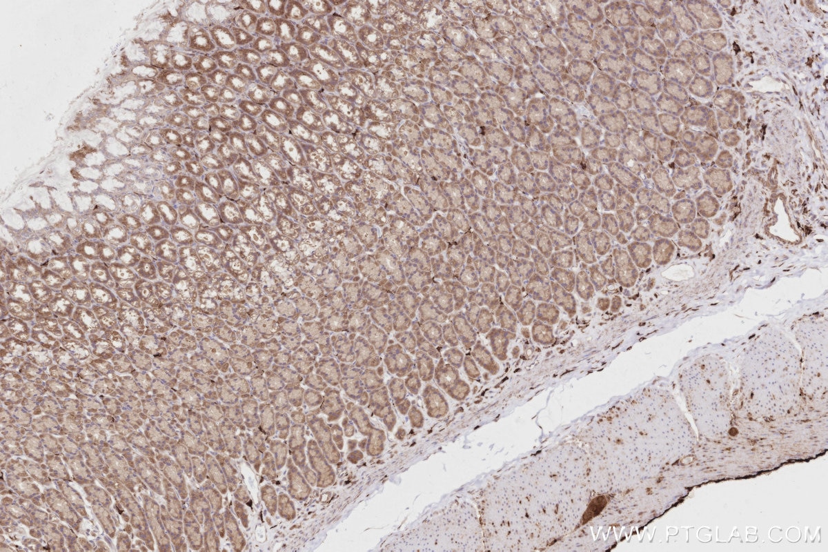 CNDP2